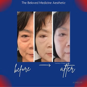 Before and After at The Beloved Medicine Clinic and Pain Center in Dallas, TX