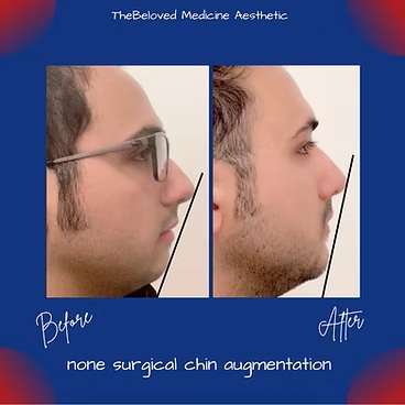 Before and After at The Beloved Medicine Clinic and Pain Center in Dallas, TX