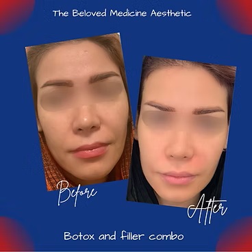Before and After at The Beloved Medicine Clinic and Pain Center in Dallas, TX