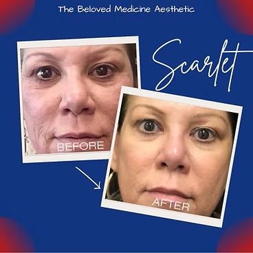 Before and After at The Beloved Medicine Clinic and Pain Center in Dallas, TX