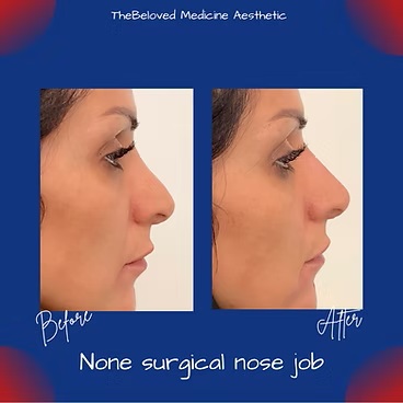 Before and After at The Beloved Medicine Clinic and Pain Center in Dallas, TX