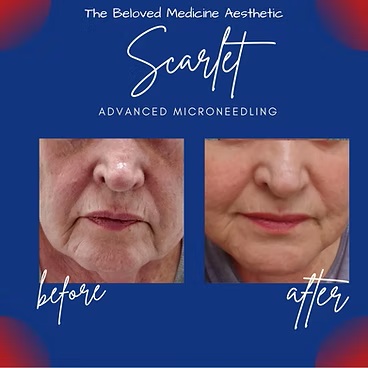 Before and After at The Beloved Medicine Clinic and Pain Center in Dallas, TX