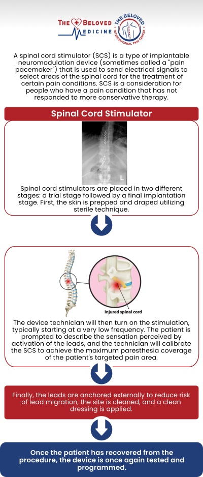 If you are searching for a Spinal Cord Stimulation Specialist in Dallas, TX, advanced and personalized care is available with Dr. John Melek at The Beloved Medicine Clinic and Pain Center Dallas. Spinal cord stimulation is a minimally invasive therapy designed to reduce chronic back, neck, and nerve pain by interrupting pain signals before they reach the brain. Our patients receive comprehensive evaluations, customized treatment plans, and compassionate care focused on long-term pain relief and improved quality of life. For more information, contact us or request an appointment online. We are conveniently located at 7777 Forest Ln Suite A315, Dallas, TX 75230.