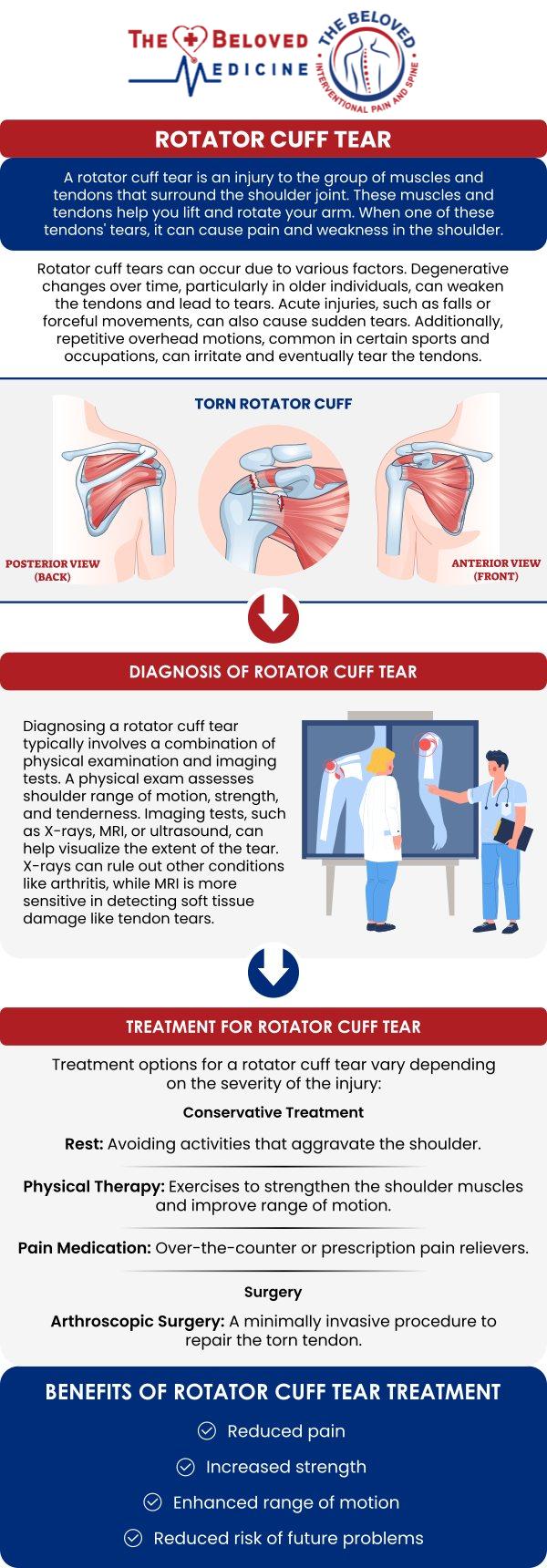 If you're dealing with a rotator cuff tear, Dr. John Melek at The Beloved Medicine Clinic, Pain and Spine Center offers expert treatment options to help you recover. Rotator cuff tears can significantly impact shoulder function, causing pain and limiting movement. Dr. Melek provides personalized care tailored to your specific needs. For more information, contact us or request an appointment online. We are conveniently located at 7777 Forest Ln Suite A315, Dallas, TX 75230. If you're dealing with a rotator cuff tear, Dr. John Melek at The Beloved Medicine Clinic, Pain and Spine Center offers expert treatment options to help you recover. Rotator cuff tears can significantly impact shoulder function, causing pain and limiting movement. Dr. Melek provides personalized care tailored to your specific needs. For more information, contact us or request an appointment online. We are conveniently located at 7777 Forest Ln Suite A315, Dallas, TX 75230.