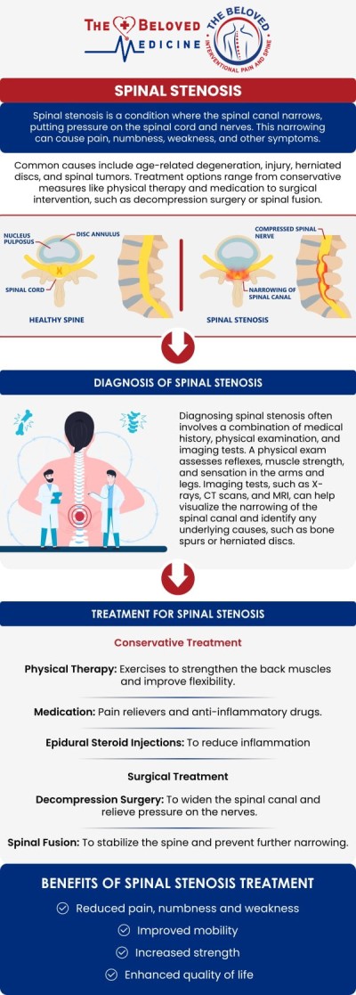 Common questions asked by clients: What is spinal stenosis? What are the common symptoms of spinal stenosis? How is spinal stenosis diagnosed? What are the treatment options for spinal stenosis? How can The Beloved Medicine help manage spinal stenosis symptoms? For more information, contact us or request an appointment online. We are conveniently located at 7777 Forest Ln Suite A315, Dallas, TX 75230.