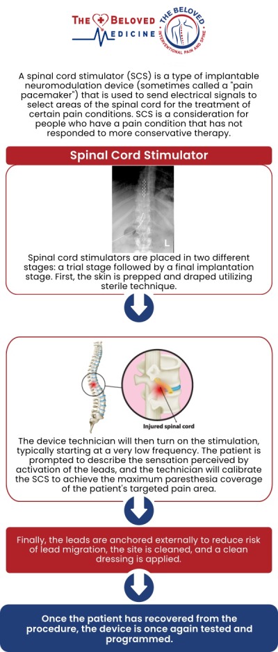 If you are searching for a Spinal Cord Stimulation Specialist in Dallas, TX, advanced and personalized care is available with Dr. John Melek at The Beloved Medicine Clinic, Pain and Spine Center Dallas. Spinal cord stimulation is a minimally invasive therapy designed to reduce chronic back, neck, and nerve pain by interrupting pain signals before they reach the brain. Our patients receive comprehensive evaluations, customized treatment plans, and compassionate care focused on long-term pain relief and improved quality of life. For more information, contact us or request an appointment online. We are conveniently located at 7777 Forest Ln Suite A315, Dallas, TX 75230. If you are searching for a Spinal Cord Stimulation Specialist in Dallas, TX, advanced and personalized care is available with Dr. John Melek at The Beloved Medicine Clinic, Pain and Spine Center Dallas. Spinal cord stimulation is a minimally invasive therapy designed to reduce chronic back, neck, and nerve pain by interrupting pain signals before they reach the brain. Our patients receive comprehensive evaluations, customized treatment plans, and compassionate care focused on long-term pain relief and improved quality of life. For more information, contact us or request an appointment online. We are conveniently located at 7777 Forest Ln Suite A315, Dallas, TX 75230.